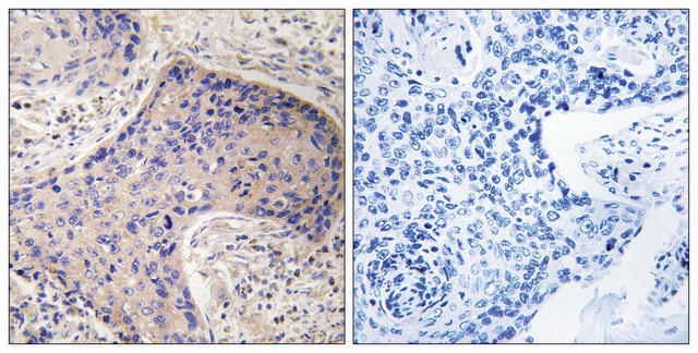 Anti-ST6GAL1 antibody produced in rabbit affinity isolated antibody