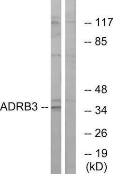 Anti-ADRB3 antibody produced in rabbit affinity isolated antibody