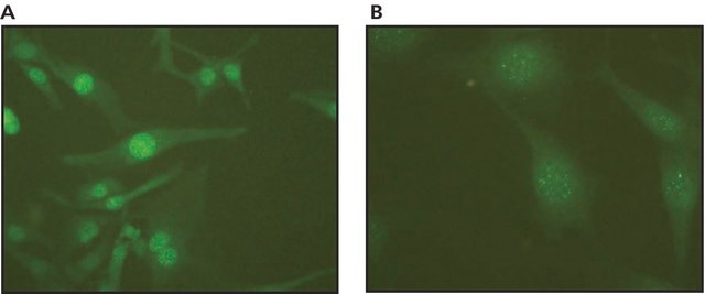 Anti-MBD2a,b (RA-18) antibody produced in rabbit affinity isolated antibody, buffered aqueous solution