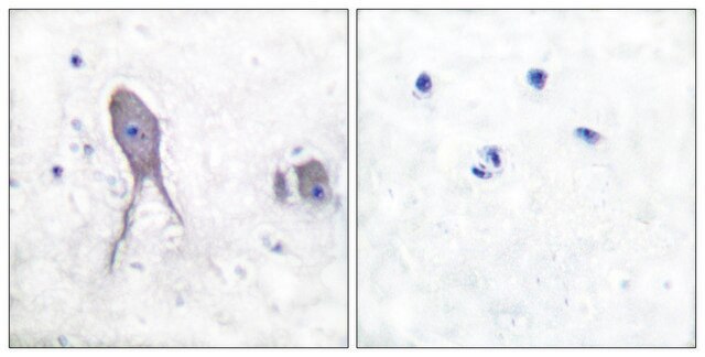 Anti-NOTCH2 (Cleaved-Asp1733) antibody produced in rabbit affinity isolated antibody