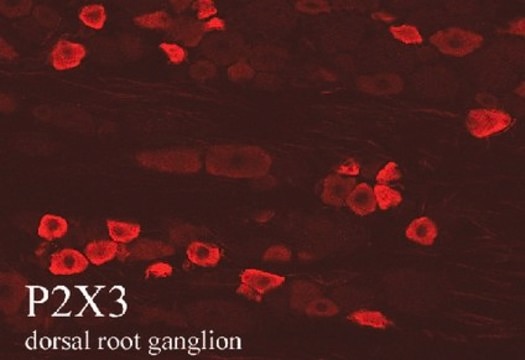 Anti-P2X3 Receptor Antibody, pain serum, Chemicon&#174;