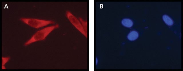 Anti-Ribosomal Protein L26 (N-terminal) antibody produced in rabbit ~1&#160;mg/mL, affinity isolated antibody, buffered aqueous solution