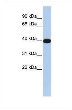 Anti-LMX1A antibody produced in rabbit affinity isolated antibody