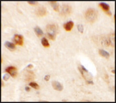 Anti-CMYA5 antibody produced in rabbit affinity isolated antibody