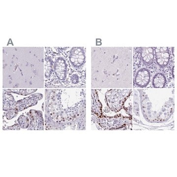 Anti-MORC4 antibody produced in rabbit Prestige Antibodies&#174; Powered by Atlas Antibodies, affinity isolated antibody, buffered aqueous glycerol solution