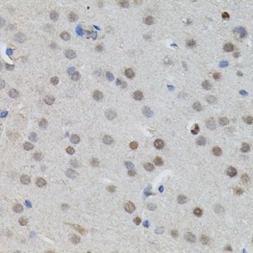 Anti-MYCN antibody produced in rabbit