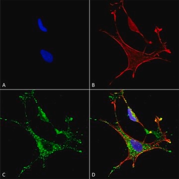 Monoclonal Anti-Copper Transporting Atpase 1 antibody produced in mouse clone S60-4, purified immunoglobulin