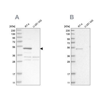 Anti-SCP2 antibody produced in rabbit Prestige Antibodies&#174; Powered by Atlas Antibodies, affinity isolated antibody, buffered aqueous glycerol solution, Ab2