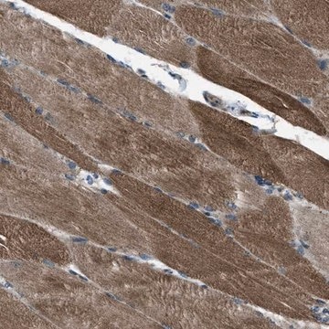 Anti-SVIL antibody produced in rabbit Prestige Antibodies&#174; Powered by Atlas Antibodies, affinity isolated antibody, buffered aqueous glycerol solution, Ab1