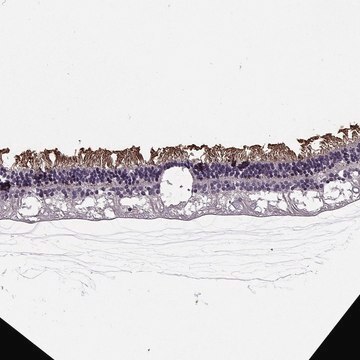 Anti-CACNA1F antibody produced in rabbit Prestige Antibodies&#174; Powered by Atlas Antibodies, affinity isolated antibody