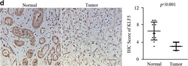 Anti-KLF5 antibody produced in rabbit Prestige Antibodies&#174; Powered by Atlas Antibodies, affinity isolated antibody, buffered aqueous glycerol solution