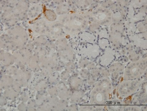 Monoclonal Anti-C3 antibody produced in mouse clone 5F9, purified immunoglobulin, buffered aqueous solution