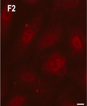 Anti-Rab5 antibody, Mouse monoclonal clone Rab5-65, purified from hybridoma cell culture