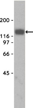 Anti-&#945;-Dystroglycan Antibody, clone VIA4-1 culture supernatant, clone VIA4-1, Upstate&#174;