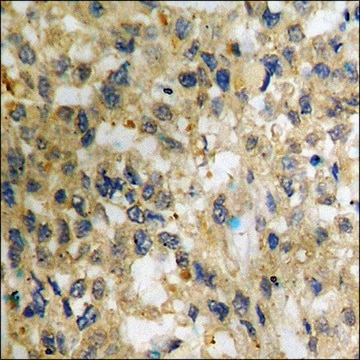 Anti-phospho-NF-kappaB p65 (pSer536) antibody produced in rabbit affinity isolated antibody