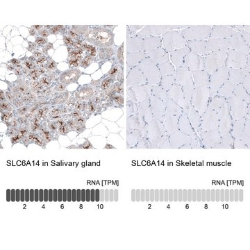 Anti-SLC6A14 antibody produced in rabbit affinity isolated antibody, buffered aqueous glycerol solution