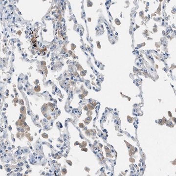 Anti-HEG1 antibody produced in rabbit Prestige Antibodies&#174; Powered by Atlas Antibodies, affinity isolated antibody, buffered aqueous glycerol solution