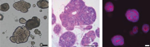 3dGRO&#174; Human CRC Organoids (ISO34)