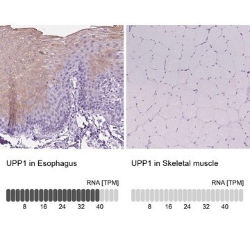 Anti-UPP1 antibody produced in rabbit Prestige Antibodies&#174; Powered by Atlas Antibodies, affinity isolated antibody, buffered aqueous glycerol solution