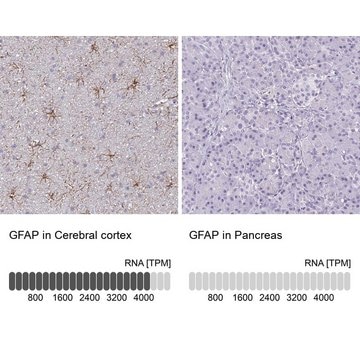 Anti-GFAP antibody produced in rabbit Prestige Antibodies&#174; Powered by Atlas Antibodies, affinity isolated antibody, buffered aqueous glycerol solution