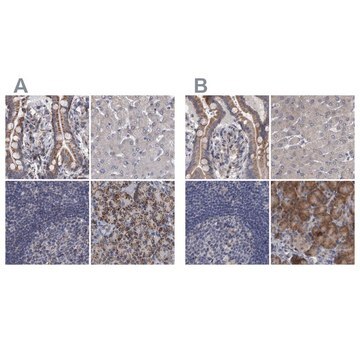 Anti-DBT antibody produced in rabbit Prestige Antibodies&#174; Powered by Atlas Antibodies, affinity isolated antibody, buffered aqueous glycerol solution, Ab2