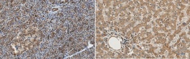 Anti-OSTM1 from rabbit, purified by affinity chromatography