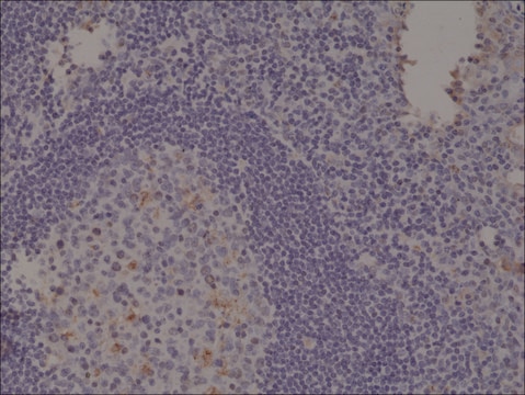 Anti-Spastin antibody, Rabbit monoclonal recombinant, expressed in HEK 293 cells, clone RM346, purified immunoglobulin