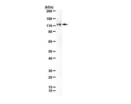 Anti-Anoctamin-1 (TMEM16A) from rabbit