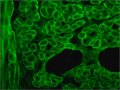 Monoclonal Anti-Dystrophin antibody produced in mouse clone MANDYS8, ascites fluid