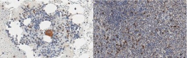 Anti-Chitinase-1 (CHIT1) from rabbit, purified by affinity chromatography