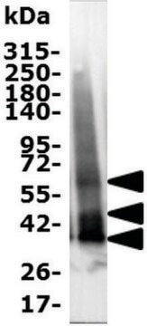 MT1 (Melatonin Receptor 1)