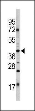 ANTI-OCT4 (OCT3) (E125) antibody produced in rabbit purified immunoglobulin, buffered aqueous solution