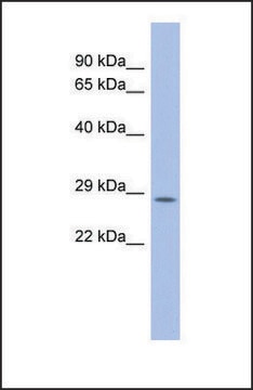 Anti-PSMB10 antibody produced in rabbit affinity isolated antibody