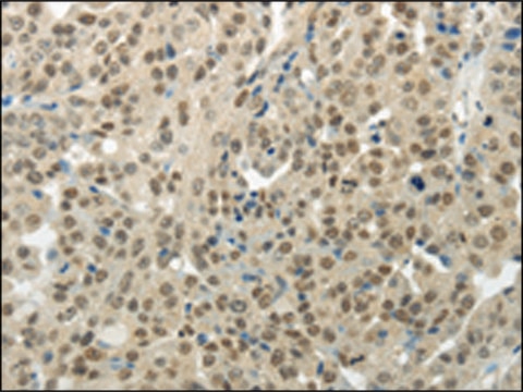 Anti-BAZ1B affinity isolated antibody