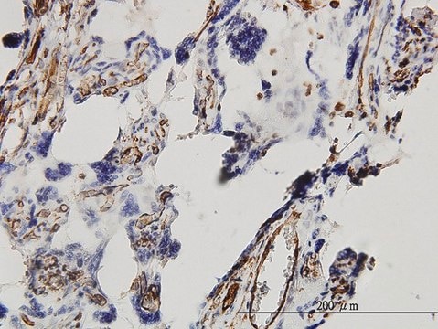 Monoclonal Anti-DKK1 antibody produced in mouse clone 2B12, purified immunoglobulin, buffered aqueous solution