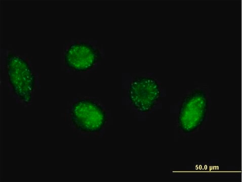 Anti-VIM antibody produced in mouse purified immunoglobulin, buffered aqueous solution