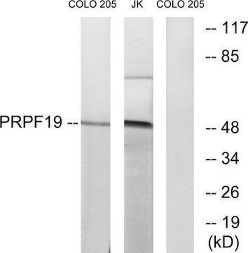 Anti-PRPF19 antibody produced in rabbit affinity isolated antibody