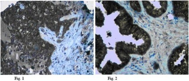 Anti-Claudin-5 Antibody from rabbit, purified by affinity chromatography