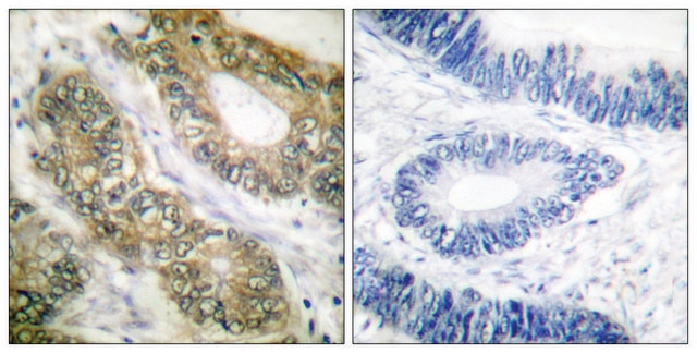 Anti-SEPARASE antibody produced in rabbit affinity isolated antibody