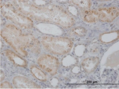 Anti-CTSH antibody produced in mouse purified immunoglobulin, buffered aqueous solution