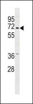 ANTI-PINK1 (PARK6) (CENTER) antibody produced in rabbit purified immunoglobulin, buffered aqueous solution