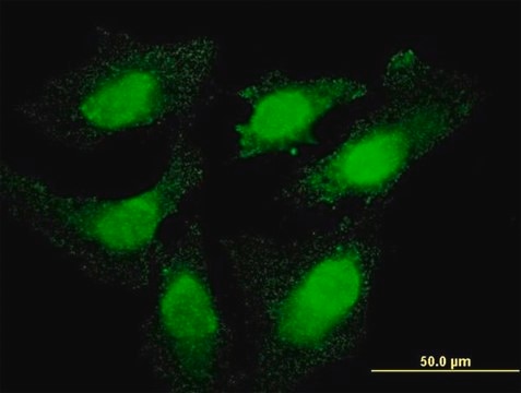 Monoclonal Anti-TOP3B antibody produced in mouse clone 1H4, purified immunoglobulin, buffered aqueous solution