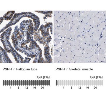 Anti-PSPH antibody produced in rabbit Prestige Antibodies&#174; Powered by Atlas Antibodies, affinity isolated antibody, buffered aqueous glycerol solution