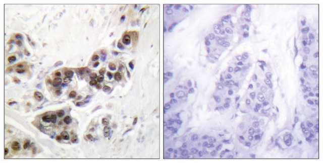 Anti-p53 antibody produced in rabbit affinity isolated antibody