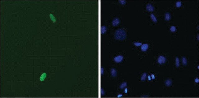 Monoclonal Anti-DUX4 antibody produced in mouse clone P2B1, 1&#160;mg/mL, purified immunoglobulin