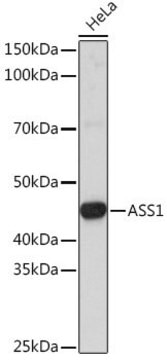 Anti- ASS1 antibody produced in rabbit