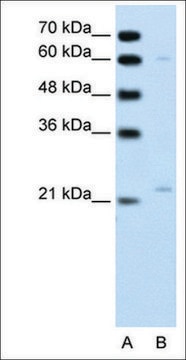 Anti-RGS4 antibody produced in rabbit affinity isolated antibody