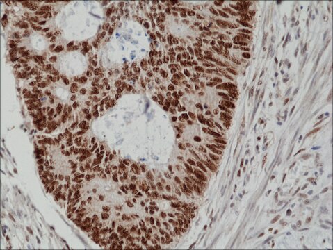 Anti-MSH2 antibody, Rabbit monoclonal recombinant, expressed in HEK 293 cells, clone RM375, purified immunoglobulin