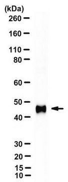 Anti-MCPyV large T-antigen Antibody, clone CM2B4 clone CM2B4, from mouse