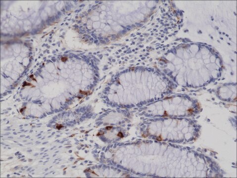 Anti-Synaptophysin antibody, Rabbit monoclonal recombinant, expressed in HEK 293 cells, clone RM258, purified immunoglobulin